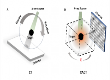 UCI Researchers Achieve 3D CT Imaging Innovation